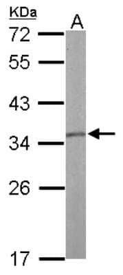 Western Blot: Tropomyosin-1 Antibody [NBP1-33716]