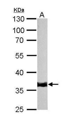 Western Blot: Tropomyosin-1 Antibody [NBP1-33716]