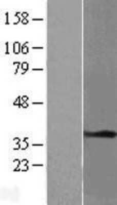 Western Blot: Tropomyosin-1 Overexpression Lysate [NBL1-17219]