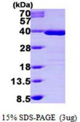 SDS-PAGE: Recombinant Human Tropomyosin-1 His Protein [NBP1-48329]