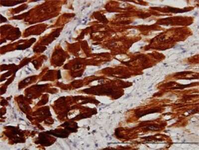 Immunohistochemistry-Paraffin: Troponin C (cardiac) Antibody (1F8-A9) [H00007134-M01]