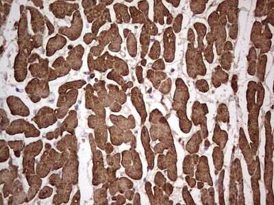 Immunohistochemistry: Troponin C (cardiac) Antibody (OTI5H3) [NBP2-46166]
