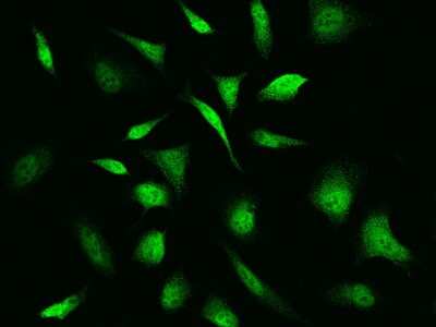 Immunocytochemistry/ Immunofluorescence: Troponin C (cardiac) Antibody [NBP2-99393]