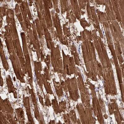 Immunohistochemistry-Paraffin: Troponin C (cardiac) Antibody [NBP2-37958]