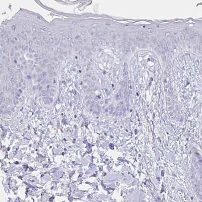 Immunohistochemistry-Paraffin: Troponin C (cardiac) Antibody [NBP2-37958]