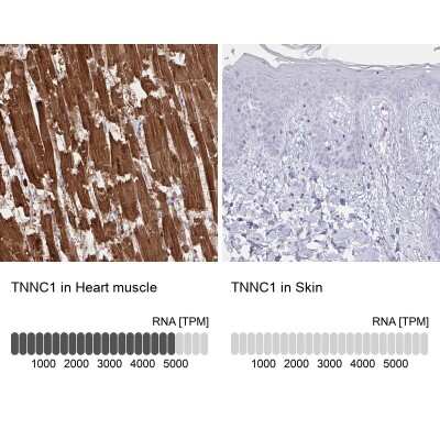 Immunohistochemistry-Paraffin: Troponin C (cardiac) Antibody [NBP2-37958]
