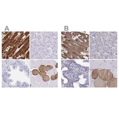 Immunohistochemistry-Paraffin: Troponin C (cardiac) Antibody [NBP2-37958]