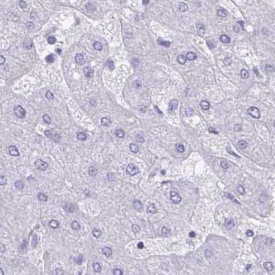 Immunohistochemistry-Paraffin: Troponin C (cardiac) Antibody [NBP2-37958]