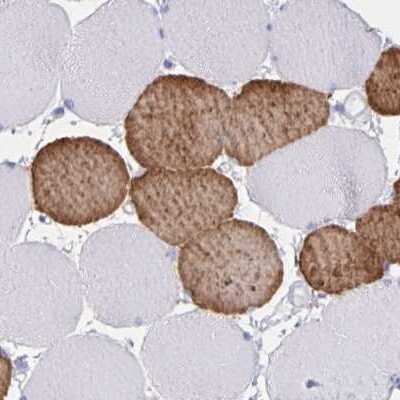 Immunohistochemistry-Paraffin: Troponin C (cardiac) Antibody [NBP2-37958]