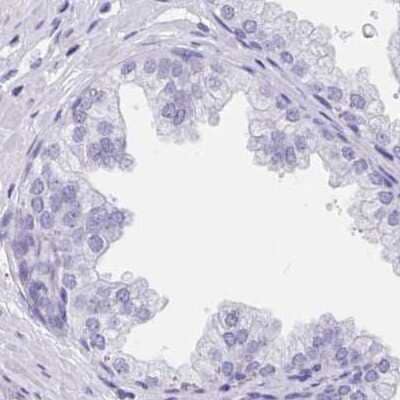 Immunohistochemistry-Paraffin: Troponin C (cardiac) Antibody [NBP2-37958]