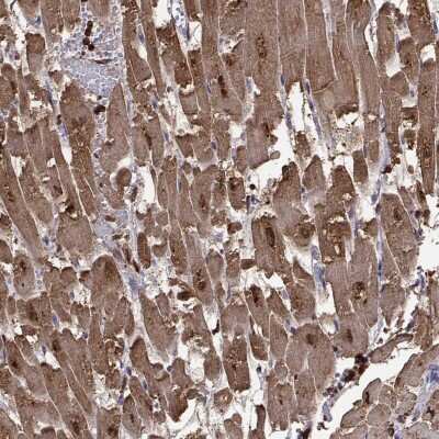 Immunohistochemistry-Paraffin: Troponin C (cardiac) Antibody [NBP2-55151]