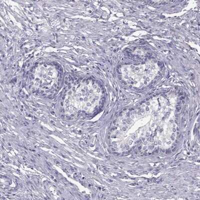Immunohistochemistry-Paraffin: Troponin C (cardiac) Antibody [NBP2-55151]