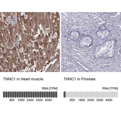 Immunohistochemistry-Paraffin: Troponin C (cardiac) Antibody [NBP2-55151]