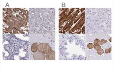 Immunohistochemistry-Paraffin: Troponin C (cardiac) Antibody [NBP2-55151]