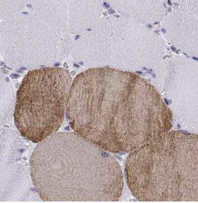 Immunohistochemistry-Paraffin: Troponin C (cardiac) Antibody [NBP2-55151]
