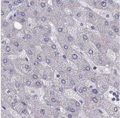 Immunohistochemistry-Paraffin: Troponin C (cardiac) Antibody [NBP2-55151]