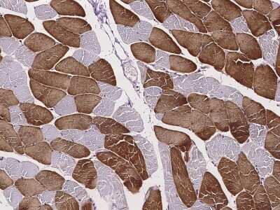 Immunohistochemistry-Paraffin: Troponin C (cardiac) Antibody [NBP2-97146]