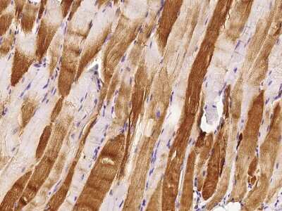 Immunohistochemistry-Paraffin: Troponin C (cardiac) Antibody [NBP2-99435]