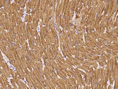 Immunohistochemistry-Paraffin: Troponin C (cardiac) Antibody [NBP2-99683]
