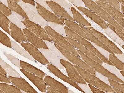 Immunohistochemistry-Paraffin: Troponin C (cardiac) Antibody [NBP2-99683]