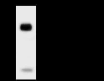 Immunoprecipitation: Troponin C (cardiac) Antibody [NBP2-99683]