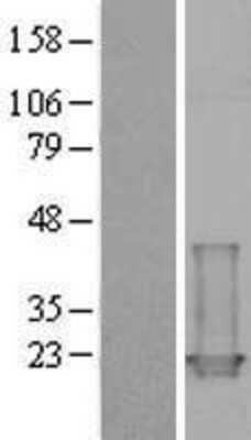 Western Blot: Troponin C (cardiac) Overexpression Lysate [NBL1-17176]