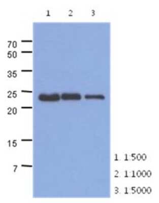 Western Blot: Troponin I Type 1 (slow skeletal) Antibody (36E7)BSA Free [NBP2-22621]