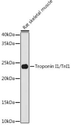 Western Blot: Troponin I Type 1 (slow skeletal) Antibody (5K1U2) [NBP3-16855]