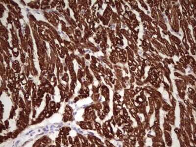 Immunohistochemistry: Troponin I Type 1 (slow skeletal) Antibody (OTI8H8) [NBP2-46170]