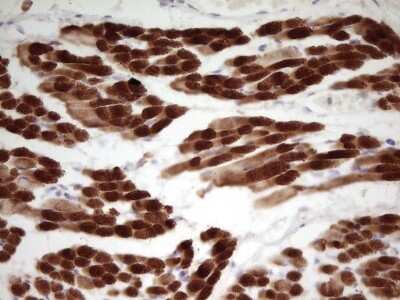Immunohistochemistry: Troponin I Type 1 (slow skeletal) Antibody (OTI8H8) [NBP2-46170]