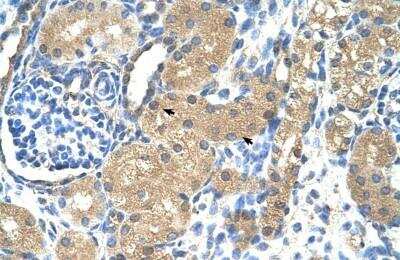 Immunohistochemistry-Paraffin: Troponin I Type 1 (slow skeletal) Antibody [NBP1-56641]