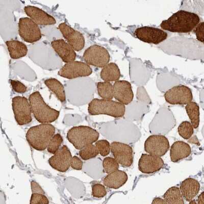 Immunohistochemistry-Paraffin: Troponin I Type 1 (slow skeletal) Antibody [NBP1-90923]