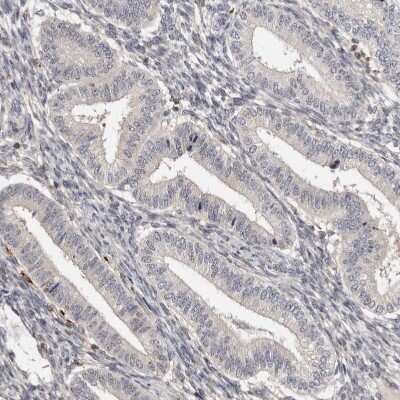 Immunohistochemistry-Paraffin: Troponin I Type 1 (slow skeletal) Antibody [NBP1-90923]