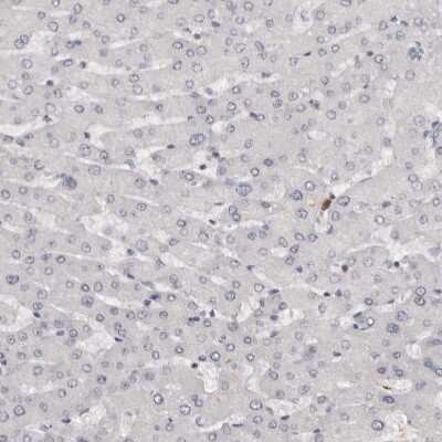 Immunohistochemistry-Paraffin: Troponin I Type 1 (slow skeletal) Antibody [NBP1-90923]