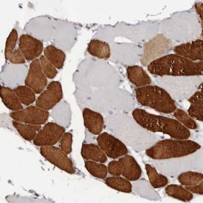 Immunohistochemistry-Paraffin: Troponin I Type 1 (slow skeletal) Antibody [NBP1-90923]