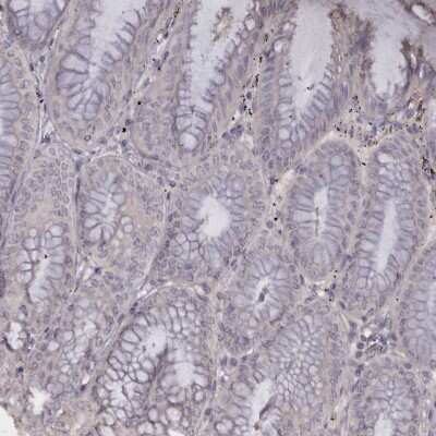Immunohistochemistry-Paraffin: Troponin I Type 1 (slow skeletal) Antibody [NBP1-90923]
