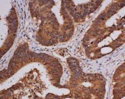 Immunohistochemistry-Paraffin: Troponin I Type 1 (slow skeletal) Antibody (OTI8H8) [NBP2-46170]