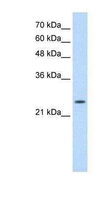 Western Blot: Troponin I Type 1 (slow skeletal) Antibody [NBP1-56641]