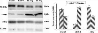 Western Blot: Troponin I Type 1 (slow skeletal) Antibody [NBP1-56641]