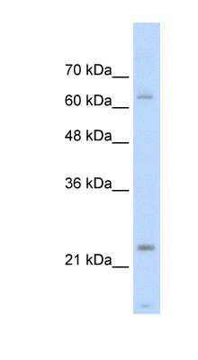 Western Blot: Troponin I Type 1 (slow skeletal) Antibody [NBP1-56642]