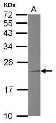 Western Blot: Troponin I Type 1 (slow skeletal) Antibody [NBP2-20733]