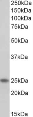 Western Blot: Troponin I Type 1 (slow skeletal) Antibody [NBP2-26202]