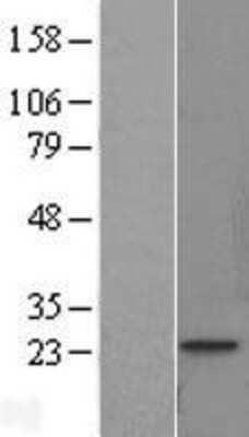 Western Blot: Troponin I Type 1 (slow skeletal) Overexpression Lysate [NBL1-17178]