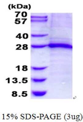 SDS-PAGE: Recombinant Human Troponin I Type 1 (slow skeletal) His Protein [NBP2-22892]