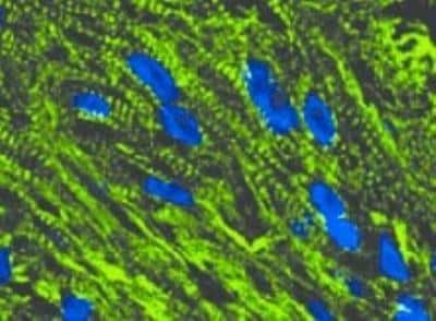 Immunohistochemistry-Paraffin: Troponin I Type 3 (cardiac) Antibody (19C7cc) [NB110-2546]