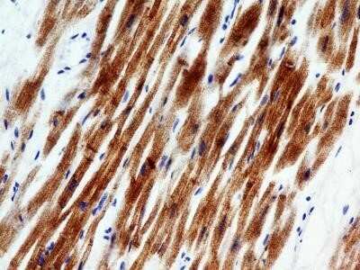 Immunocytochemistry: Troponin I Type 3 (cardiac) Antibody (1E10) - Azide and BSA Free [NBP2-80996]