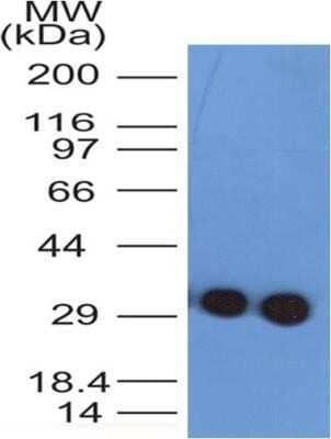 Western Blot: Troponin I Type 3 (cardiac) Antibody (1E10)Azide and BSA Free [NBP2-80996]