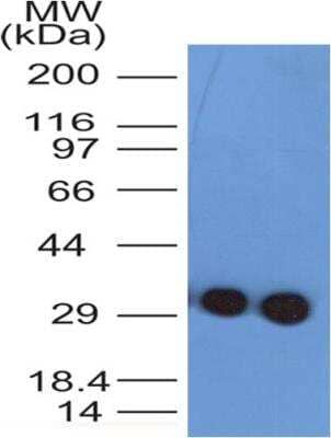 Western Blot: Troponin I Type 3 (cardiac) Antibody (1E10)BSA Free [NBP2-35337]