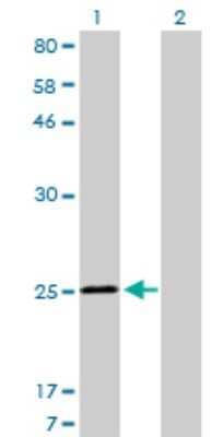 Western Blot: Troponin I Type 3 (cardiac) Antibody (1E7) [H00007137-M04]