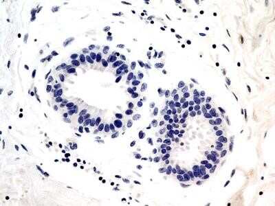 Immunocytochemistry: Troponin I Type 3 (cardiac) Antibody (2C9) - Azide and BSA Free [NBP2-80995]